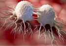 درمان توده‌های سرطانی با کمک نانوذره‌های مغناطیسی