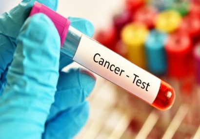 پوشش بیمه ۳ سرطان شایع در دستورکار/برقراری پوشش آزمایشات HPV