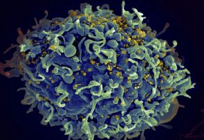 هفتمین نفر در جهان از ایدز رهایی یافت
