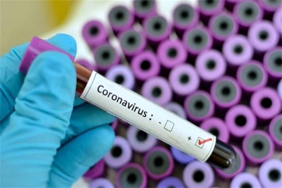 کووید ۱۹؛ شایعترین ویروس بیماری‌های تنفسی در خرداد امسال