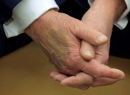 مشاهده دوباره کبودی بر روی دست ترامپ و افزایش گمانه زنی ها در باره سلامتی وی