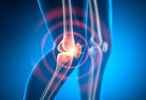بهترین راه مقابله با آرتروز زانو چیست؟