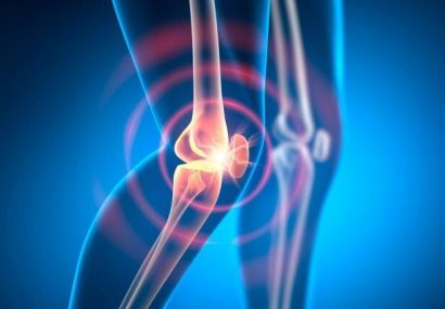 بهترین راه مقابله با آرتروز زانو چیست؟