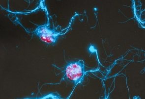 فیلم‌برداری از مهمانی میکروب‌ها در اقیانوس با کاوشگر مولکولی