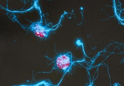 فیلم‌برداری از مهمانی میکروب‌ها در اقیانوس با کاوشگر مولکولی