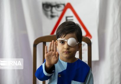 درمان بیش از ۱۳ هزار مورد تنبلی چشم در کودکان