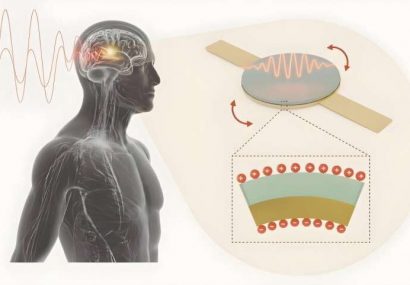 پایان باتری و آغاز ایمپلنت‌های بی‌سیم در جراحی پزشکی