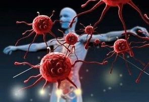 نیمی از مردم علائم سرطان را نمیدانند/نقش مشارکت مردمی در پیشگیری و تشخیص زودهنگام نیمی از مردم علائم سرطان را نمیدانند/نقش مشارکت مردمی در پیشگیری و تشخیص زودهنگام