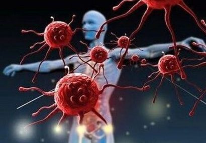 نیمی از مردم علائم سرطان را نمیدانند/نقش مشارکت مردمی در پیشگیری و تشخیص زودهنگام نیمی از مردم علائم سرطان را نمیدانند/نقش مشارکت مردمی در پیشگیری و تشخیص زودهنگام