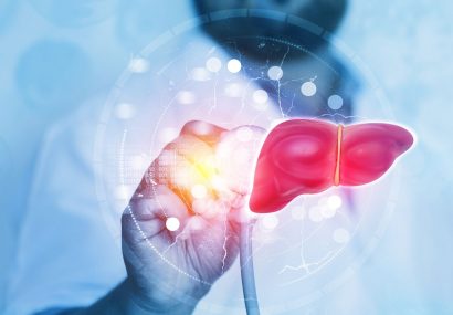 ۵ نشانه روی صورت که فریاد می‌زند کبدتان چرب است